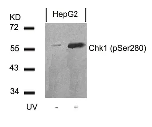 Anti-Chk1 (phospho Ser280) antibody used in Western Blot (WB). GTX50200