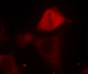 Anti-MEK3 (phospho Ser189) antibody used in Immunocytochemistry/ Immunofluorescence (ICC/IF). GTX50203