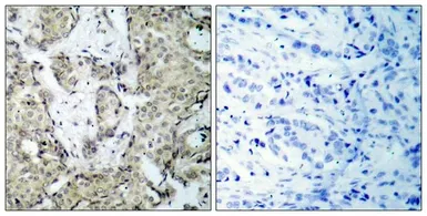 Anti-MEK3 (phospho Ser189) antibody used in IHC (Paraffin sections) (IHC-P). GTX50203