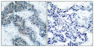 Anti-JAK2 (phospho Tyr1007) antibody used in IHC (Paraffin sections) (IHC-P). GTX50208