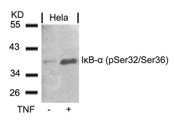 Anti-IKB alpha (phospho Ser32/Ser36) antibody used in Western Blot (WB). GTX50209