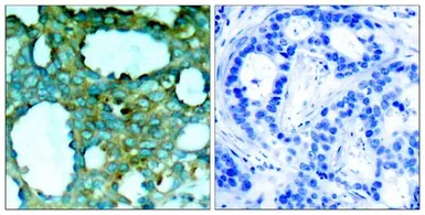Anti-PAK1 (phospho Thr212) antibody used in IHC (Paraffin sections) (IHC-P). GTX50211