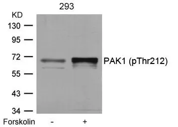 Anti-PAK1 (phospho Thr212) antibody used in Western Blot (WB). GTX50211