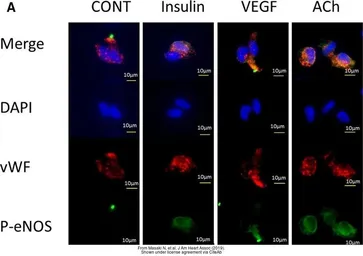Anti-eNOS (phospho Ser1177) antibody used in Immunocytochemistry/ Immunofluorescence (ICC/IF). GTX50212