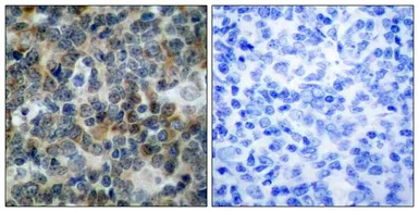 Anti-VASP (phospho Ser239) antibody used in IHC (Paraffin sections) (IHC-P). GTX50213