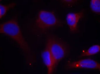 Anti-ZAP70 (phospho Tyr319) antibody used in Immunocytochemistry/ Immunofluorescence (ICC/IF). GTX50214