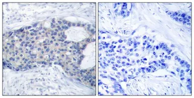 Anti-ZAP70 (phospho Tyr493) antibody used in IHC (Paraffin sections) (IHC-P). GTX50215