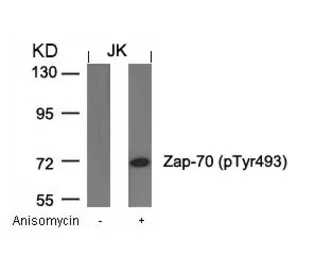 Anti-ZAP70 (phospho Tyr493) antibody used in Western Blot (WB). GTX50215