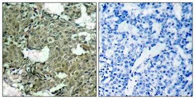 Anti-MEK1 (phospho Ser221) antibody used in IHC (Paraffin sections) (IHC-P). GTX50216