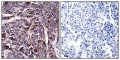 Anti-NFkB p65 (phospho Thr505) antibody used in IHC (Paraffin sections) (IHC-P). GTX50219