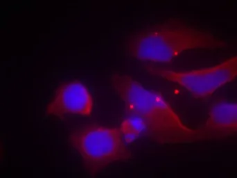 Anti-NMDAR2B (phospho Tyr1472) antibody used in Immunocytochemistry/ Immunofluorescence (ICC/IF). GTX50221