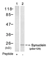 Anti-alpha Synuclein (phospho Ser129) antibody used in Western Blot (WB). GTX50222