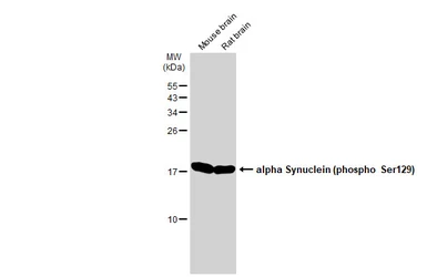 Anti-alpha Synuclein (phospho Ser129) antibody used in Western Blot (WB). GTX50222