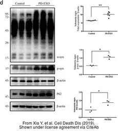 Anti-alpha Synuclein (phospho Ser129) antibody used in Western Blot (WB). GTX50222