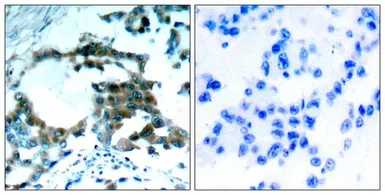 Anti-PKC theta (phospho Ser695) antibody used in IHC (Paraffin sections) (IHC-P). GTX50223