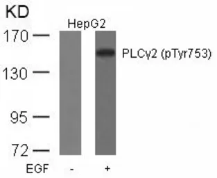 Anti-PLCG2 (phospho Tyr753) antibody used in Western Blot (WB). GTX50225