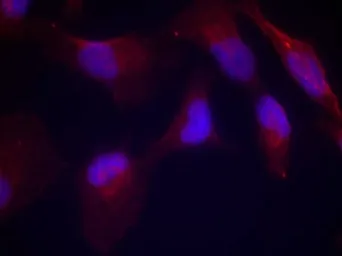 Anti-SEK1 / MKK4 (phospho Thr261) antibody used in Immunocytochemistry/ Immunofluorescence (ICC/IF). GTX50226