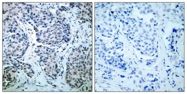 Anti-SEK1 / MKK4 (phospho Thr261) antibody used in IHC (Paraffin sections) (IHC-P). GTX50226