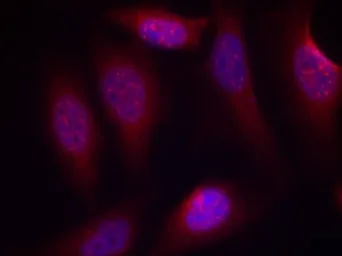 Anti-SEK1 / MKK4 (phospho Ser80) antibody used in Immunocytochemistry/ Immunofluorescence (ICC/IF). GTX50227