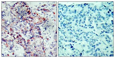Anti-SEK1 / MKK4 (phospho Ser80) antibody used in IHC (Paraffin sections) (IHC-P). GTX50227