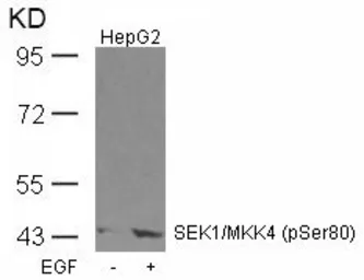 Anti-SEK1 / MKK4 (phospho Ser80) antibody used in Western Blot (WB). GTX50227