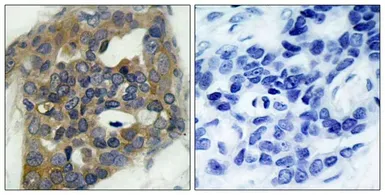 Anti-ASK1 (phospho Ser966) antibody used in IHC (Paraffin sections) (IHC-P). GTX50229