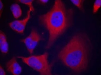 Anti-alpha Adducin (phospho Ser726) antibody used in Immunocytochemistry/ Immunofluorescence (ICC/IF). GTX50230