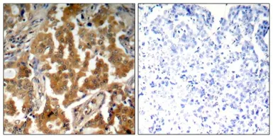 Anti-alpha Adducin (phospho Ser726) antibody used in IHC (Paraffin sections) (IHC-P). GTX50230