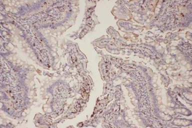 Anti-EGFR (phospho Thr654) antibody used in IHC (Paraffin sections) (IHC-P). GTX50233