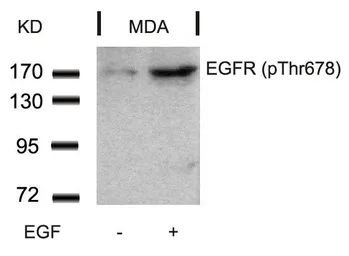 Anti-EGFR (phospho Thr654) antibody used in Western Blot (WB). GTX50233