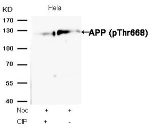 Anti-APP (phospho Thr668) antibody used in Western Blot (WB). GTX50235