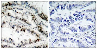 Anti-SMC1 (phospho Ser957) antibody used in IHC (Paraffin sections) (IHC-P). GTX50241