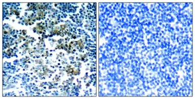 Anti-Bcr (phospho Tyr177) antibody used in IHC (Paraffin sections) (IHC-P). GTX50242