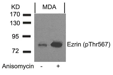 Anti-Ezrin (phospho Thr567) antibody used in Western Blot (WB). GTX50244