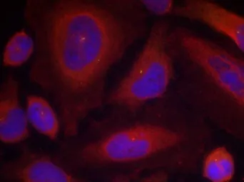 Anti-Synaptotagmin 1 (phospho Ser312) + Synaptotagmin 2 (phospho Ser309) antibody used in Immunocytochemistry/ Immunofluorescence (ICC/IF). GTX50249