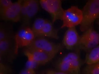 Anti-Synaptotagmin 1 (phospho Thr202) + Synaptotagmin 2 (phospho Thr199) antibody used in Immunocytochemistry/ Immunofluorescence (ICC/IF). GTX50250