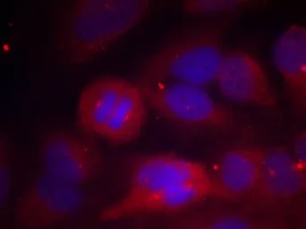 Anti-Tyrosine Hydroxylase (phospho Ser40) antibody used in Immunocytochemistry/ Immunofluorescence (ICC/IF). GTX50251