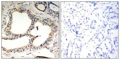 Anti-IKB epsilon (phospho Ser22) antibody used in IHC (Paraffin sections) (IHC-P). GTX50252