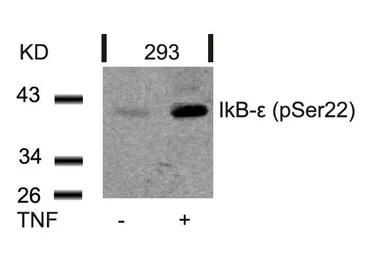 Anti-IKB epsilon (phospho Ser22) antibody used in Western Blot (WB). GTX50252