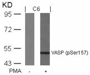 Anti-VASP (phospho Ser157) antibody used in Western Blot (WB). GTX50253