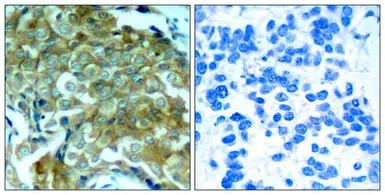 Anti-EGFR (phospho Tyr1148) antibody used in IHC (Paraffin sections) (IHC-P). GTX50257