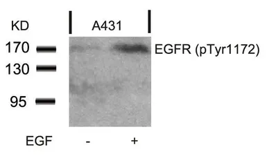 Anti-EGFR (phospho Tyr1148) antibody used in Western Blot (WB). GTX50257
