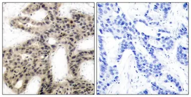 Anti-4E-BP1 (phospho Thr45) antibody used in IHC (Paraffin sections) (IHC-P). GTX50259
