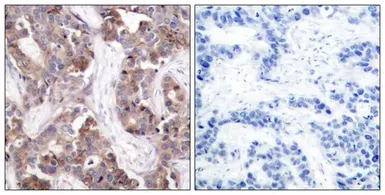 Anti-Stathmin 1 (phospho Ser25) antibody used in IHC (Paraffin sections) (IHC-P). GTX50260