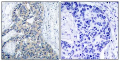 Anti-Stathmin 1 (phospho Ser38) antibody used in IHC (Paraffin sections) (IHC-P). GTX50261