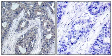 Anti-IRS1 (phospho Ser636) antibody used in IHC (Paraffin sections) (IHC-P). GTX50265