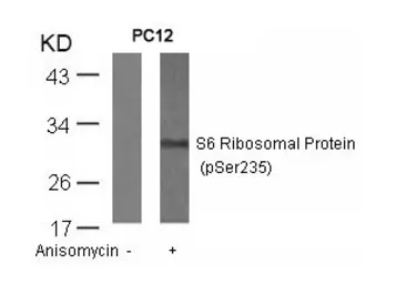 Anti-RPS6 (phospho Ser235) antibody used in Western Blot (WB). GTX50267