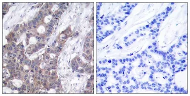 Anti-Stathmin 1 (phospho Ser16) antibody used in IHC (Paraffin sections) (IHC-P). GTX50269