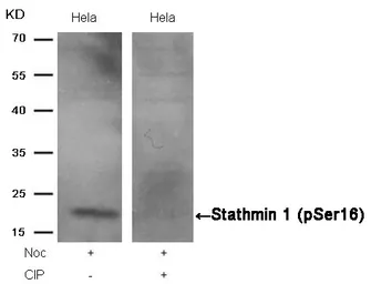 Anti-Stathmin 1 (phospho Ser16) antibody used in Western Blot (WB). GTX50269