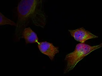Anti-HSP27 (phospho Ser78) antibody used in Immunocytochemistry/ Immunofluorescence (ICC/IF). GTX50276
